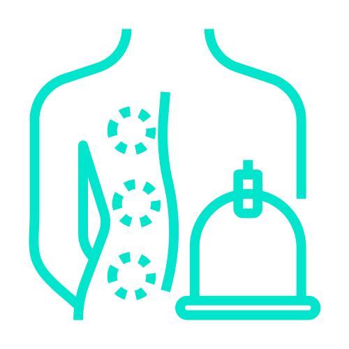 Kinetic Cupping